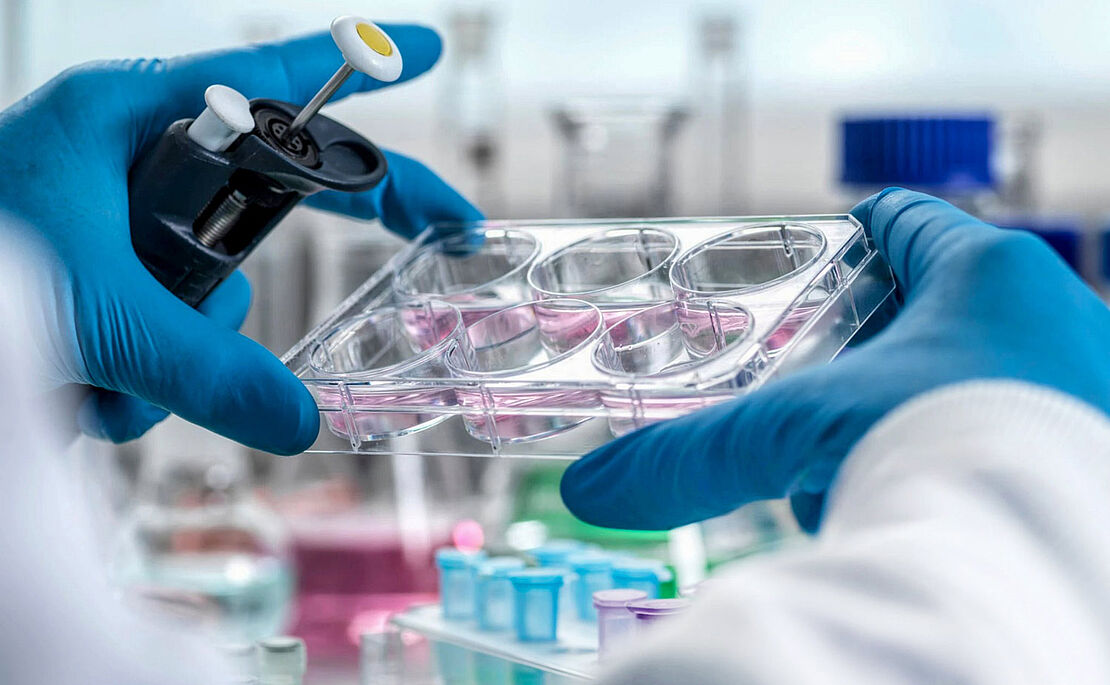 Zwei Hände in blauen Gummihandschuhen halten eine Tüpfelplatte