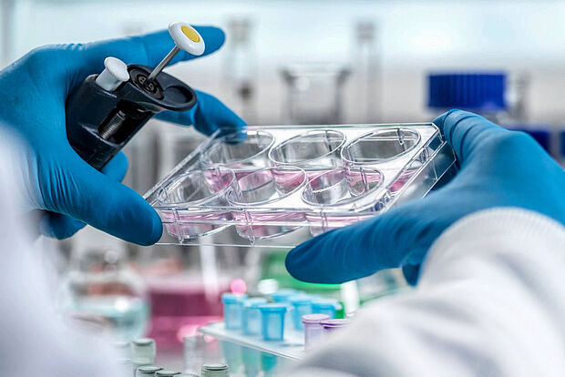 Zwei Hände in blauen Gummihandschuhen halten eine Tüpfelplatte